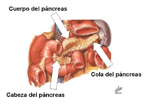 Cáncer de Páncreas