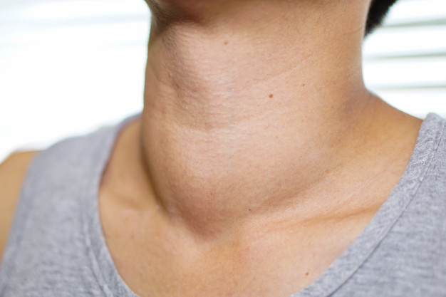 Conozca el riesgo de cáncer de tiroides